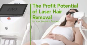 Profit Potential of Laser Hair Removal