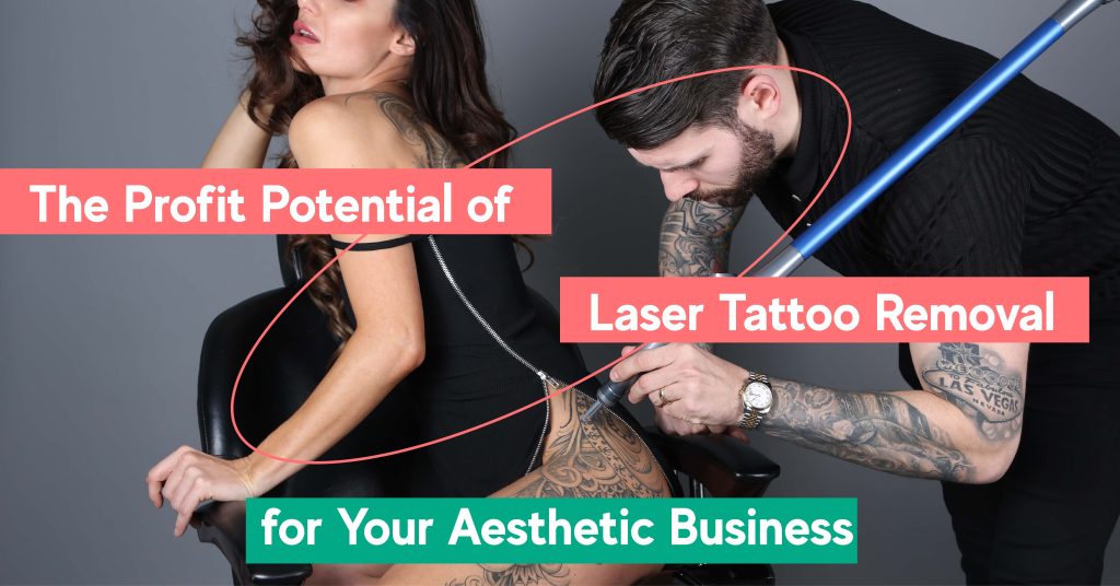 o potencial de lucro para negócios de remoção de tatuagens no Reino Unido