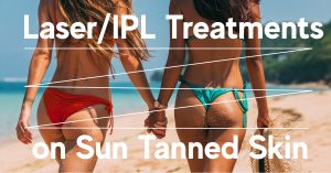 ipl treatments on tanned skin