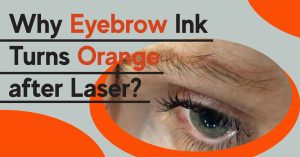 orange after laser