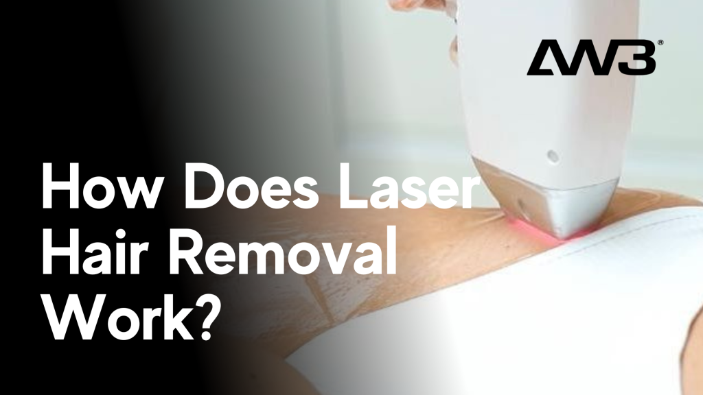 Wie funktioniert die Laser-Haarentfernung?